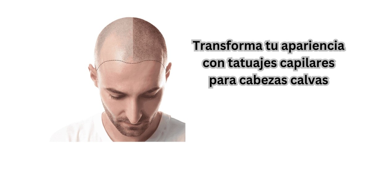 Transforma tu apariencia con tatuajes capilares para cabezas calvas