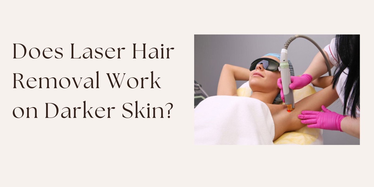 Does Laser Hair Removal Work on Darker Skin?